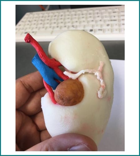 Urologist Mumbai