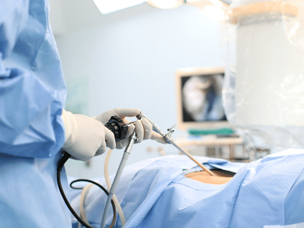 AUM - Advanced Urology Mumbai | Laparoscopic Surgery for Kidney Cancer