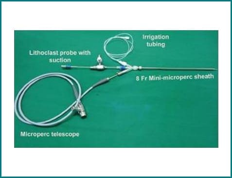 AUM - Advanced Urology Mumbai | Mini-Microperc Set-up with Lithoclast Probe