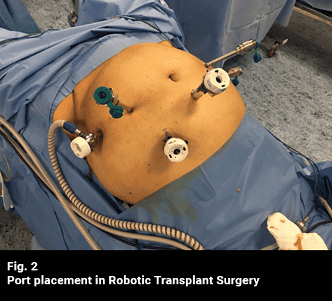 AUM - Advanced Urology Mumbai | Robotic Transplant Surgery