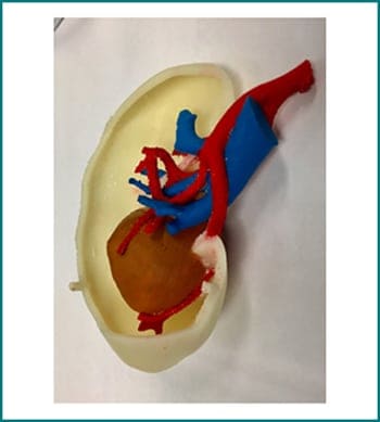 Urologist Mumbai