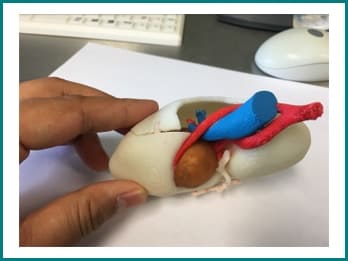 AUM - Advanced Urology Mumbai